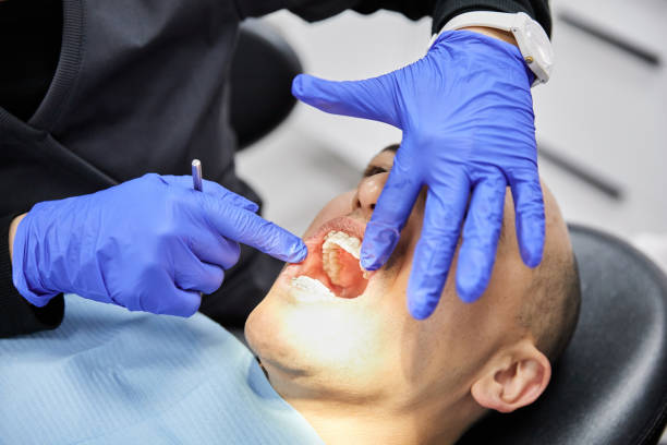 Best Urgent Care for Lost Fillings or Crowns in Lochmoor Waterway Estates, FL